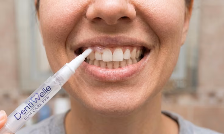 Nib laying gel where teeth meet gums