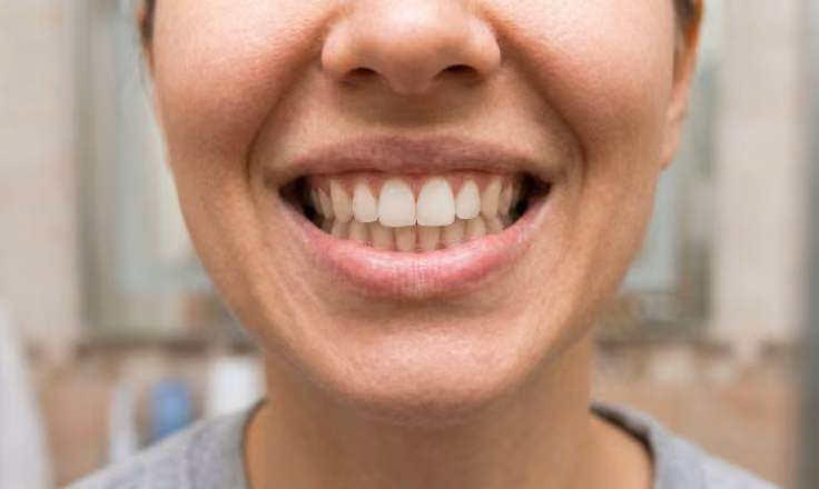Big relaxed grin after a quick Dentiwelle swipe